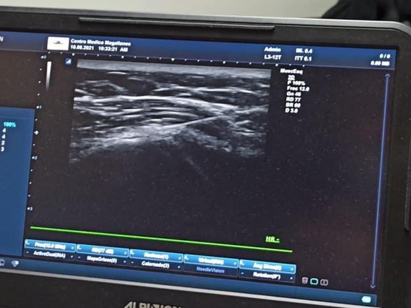 Ecógrafo musculoesquelético